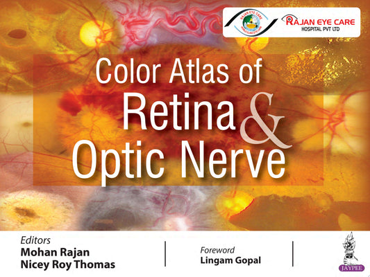 Color Atlas of Retina and Optic Nerve 1st Edition by Jaypee PDF