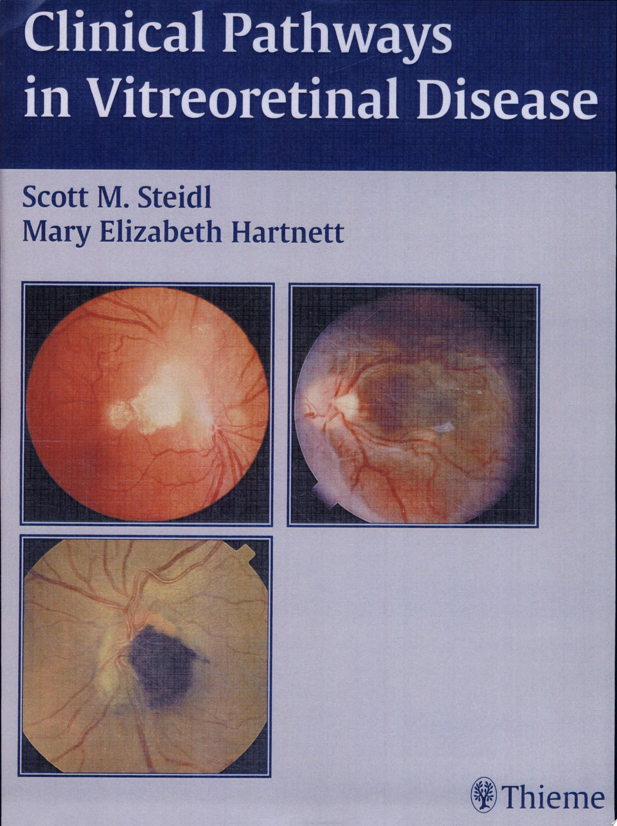 Clinical Pathways in Vitreoretinal Disease 1st Edition by Thieme PDF