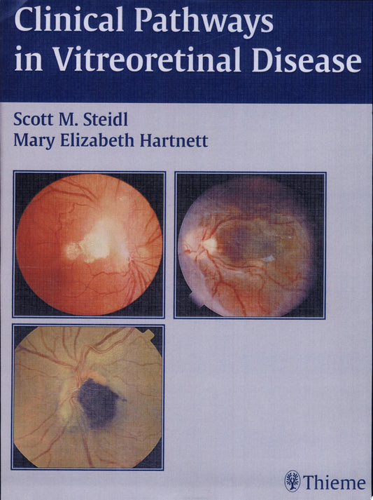Clinical Pathways in Vitreoretinal Disease 1st Edition by Thieme PDF