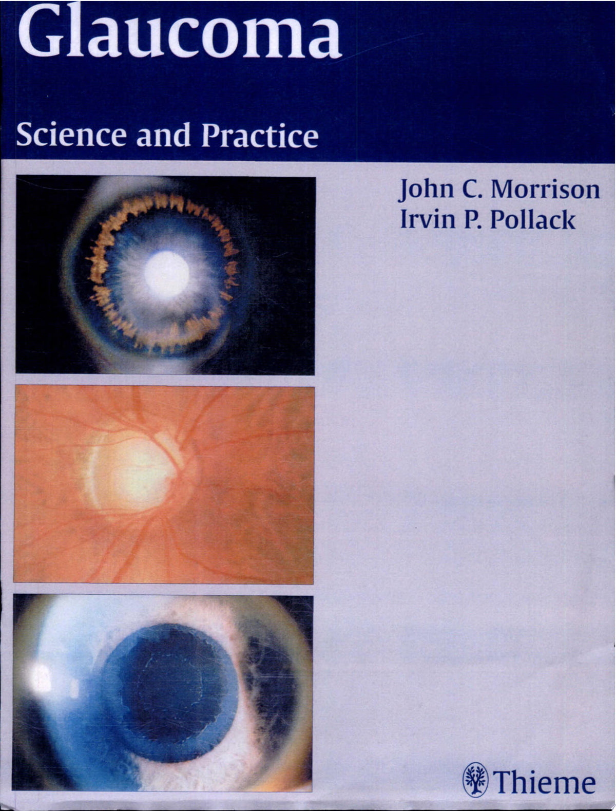 Glaucoma: Science and Practice 1st Edition by Morrison PDF