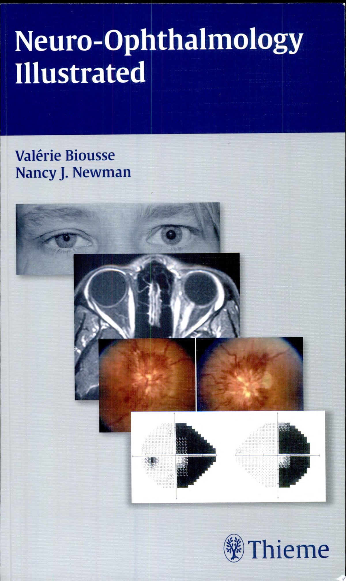 Neuro-Ophthalmology Illustrated 2nd Edition by Thieme PDF