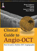 Clinical Guide to Angio-OCT 1st Edition by Fujimoto PDF