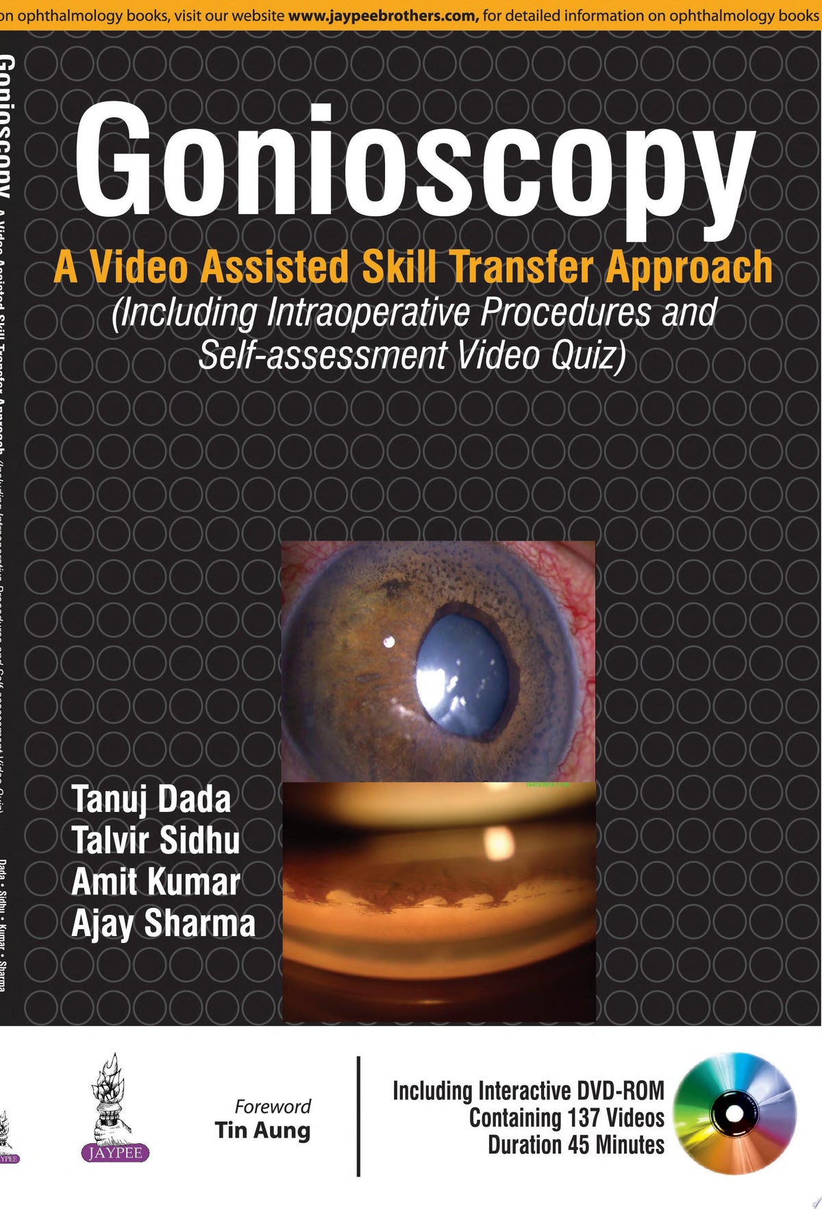 Gonioscopy: A Video Assisted Skill Transfer Approach 1st Edition by Jaypee PDF