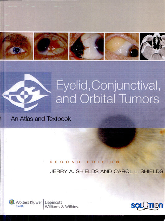 Eyelid, Conjunctival, and Orbital Tumors 3rd Edition by Lippincott Williams & Wilkins PDF