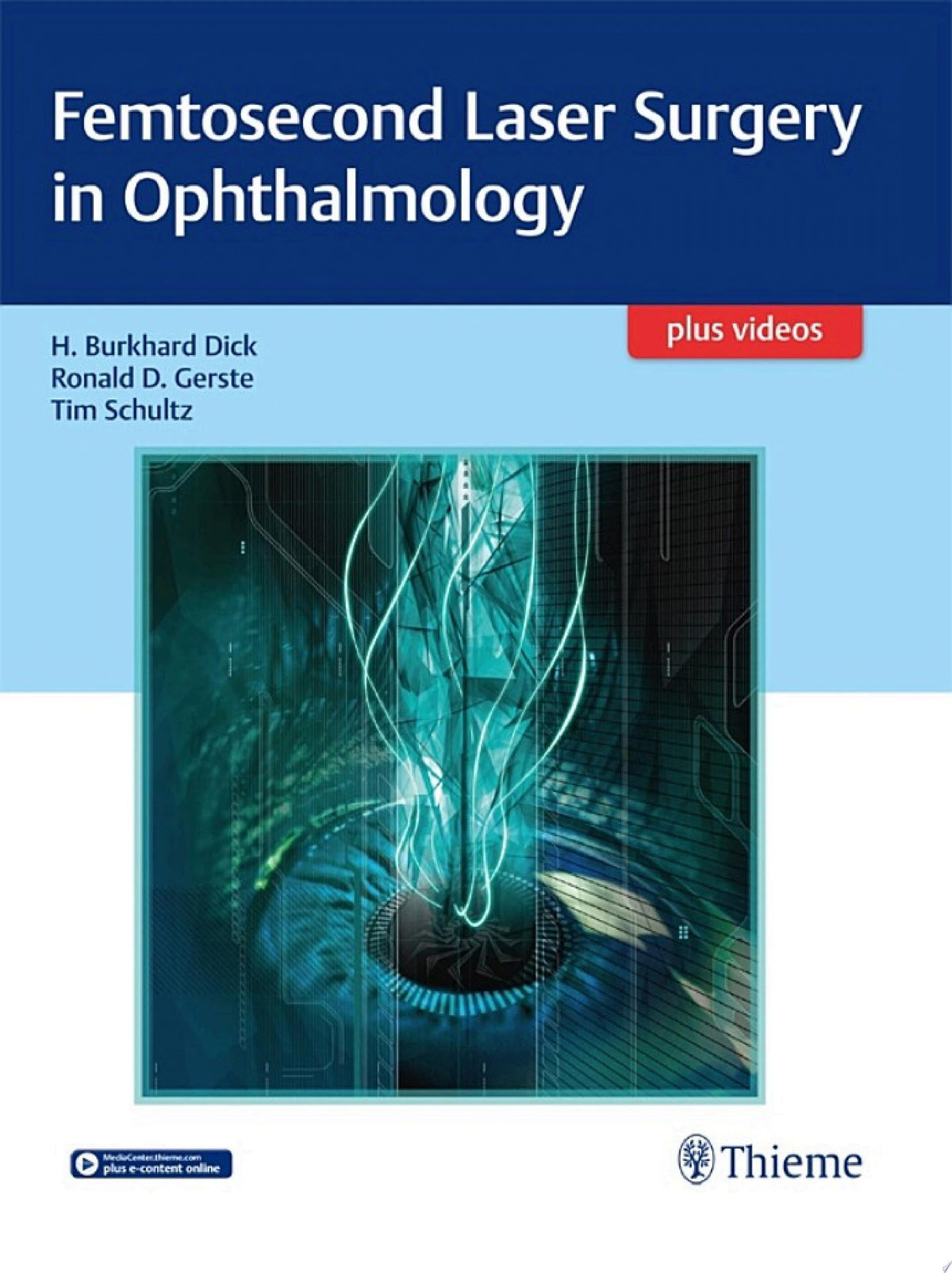 Femtosecond Laser Surgery in Ophthalmology 1st Edition by Thieme PDF