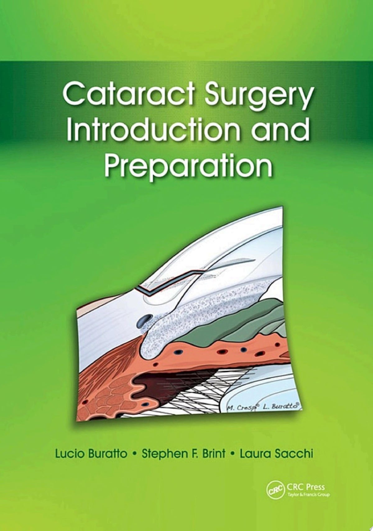 Cataract Surgery Introduction and Preparation 1st Edition PDF