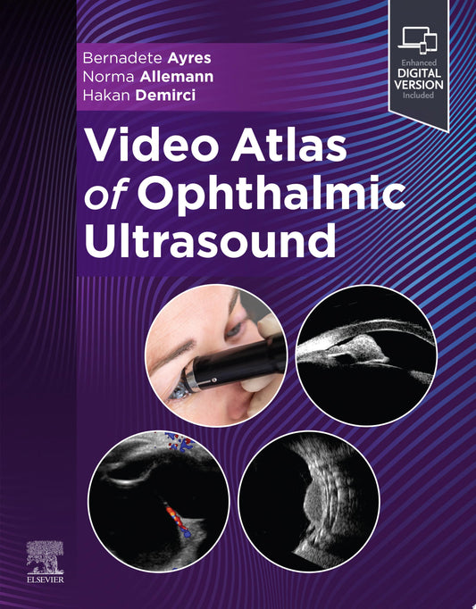 Video Atlas of Ophthalmic Ultrasound 1st Edition PDF