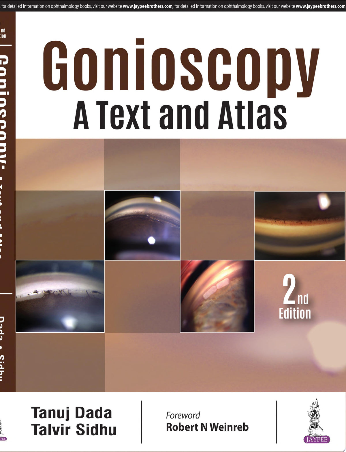 Gonioscopy: A Text and Atlas 2nd Edition by Jaypee PDF