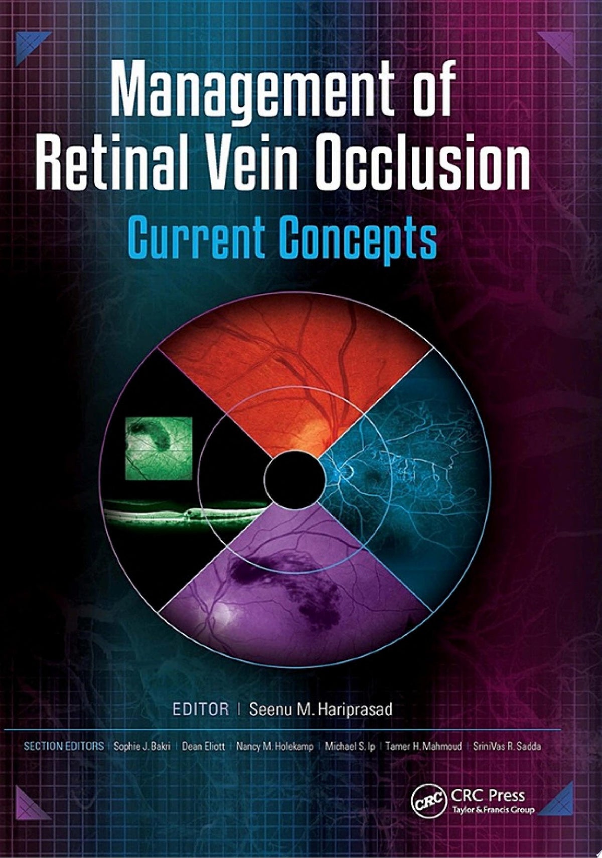 Management of Retinal Vein Occlusion: Current Concepts 1st Edition by Slack Incorporated PDF