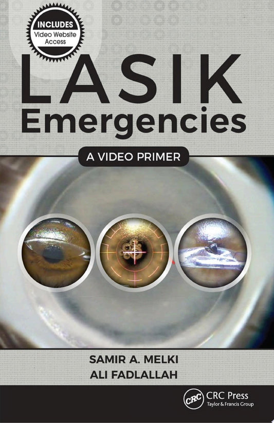 LASIK Emergencies: A Video Primer 1st Edition by Slack Incorporated PDF