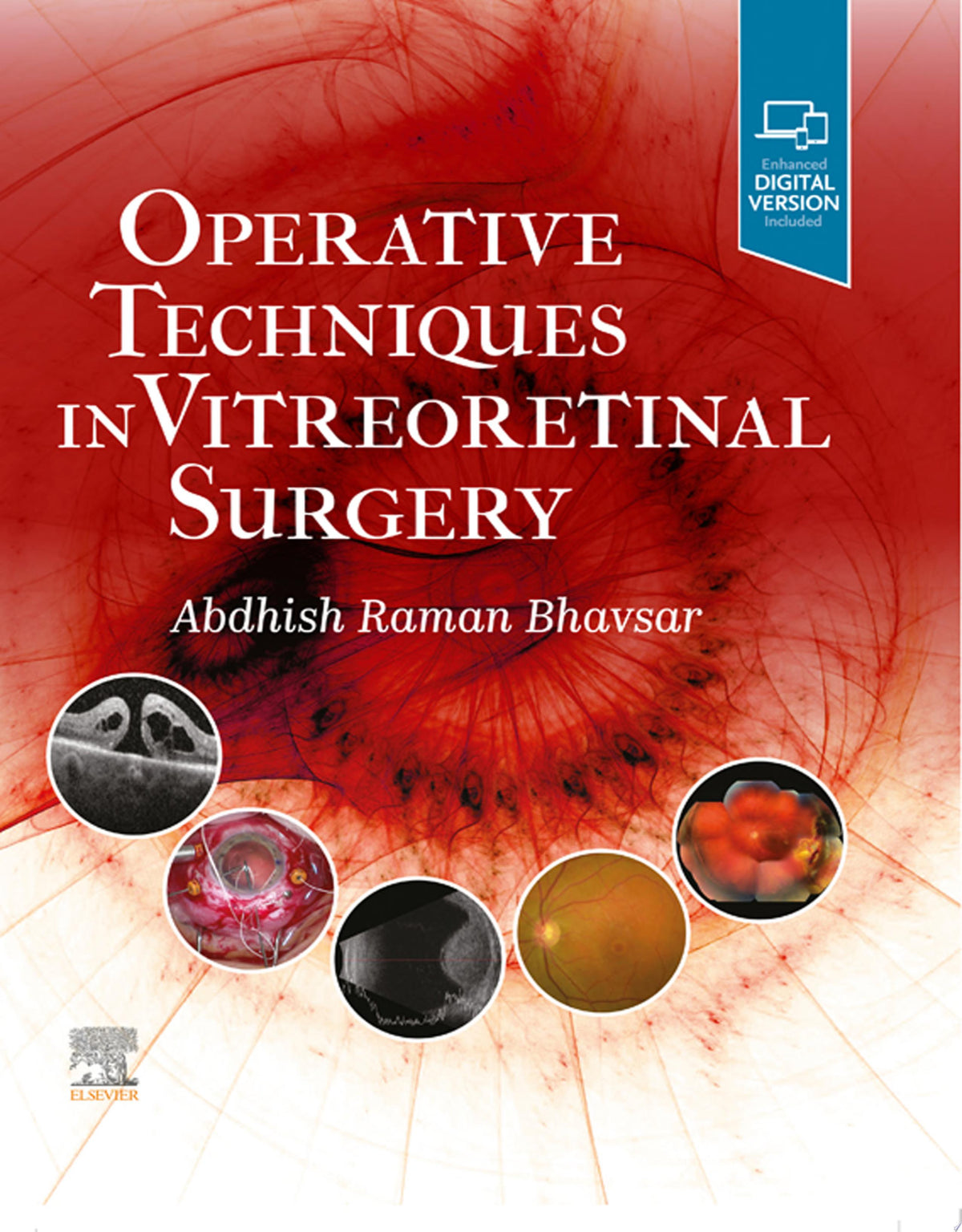 Operative Techniques in Vitreoretinal Surgery 1st Edition PDF
