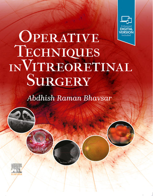 Operative Techniques in Vitreoretinal Surgery 1st Edition PDF