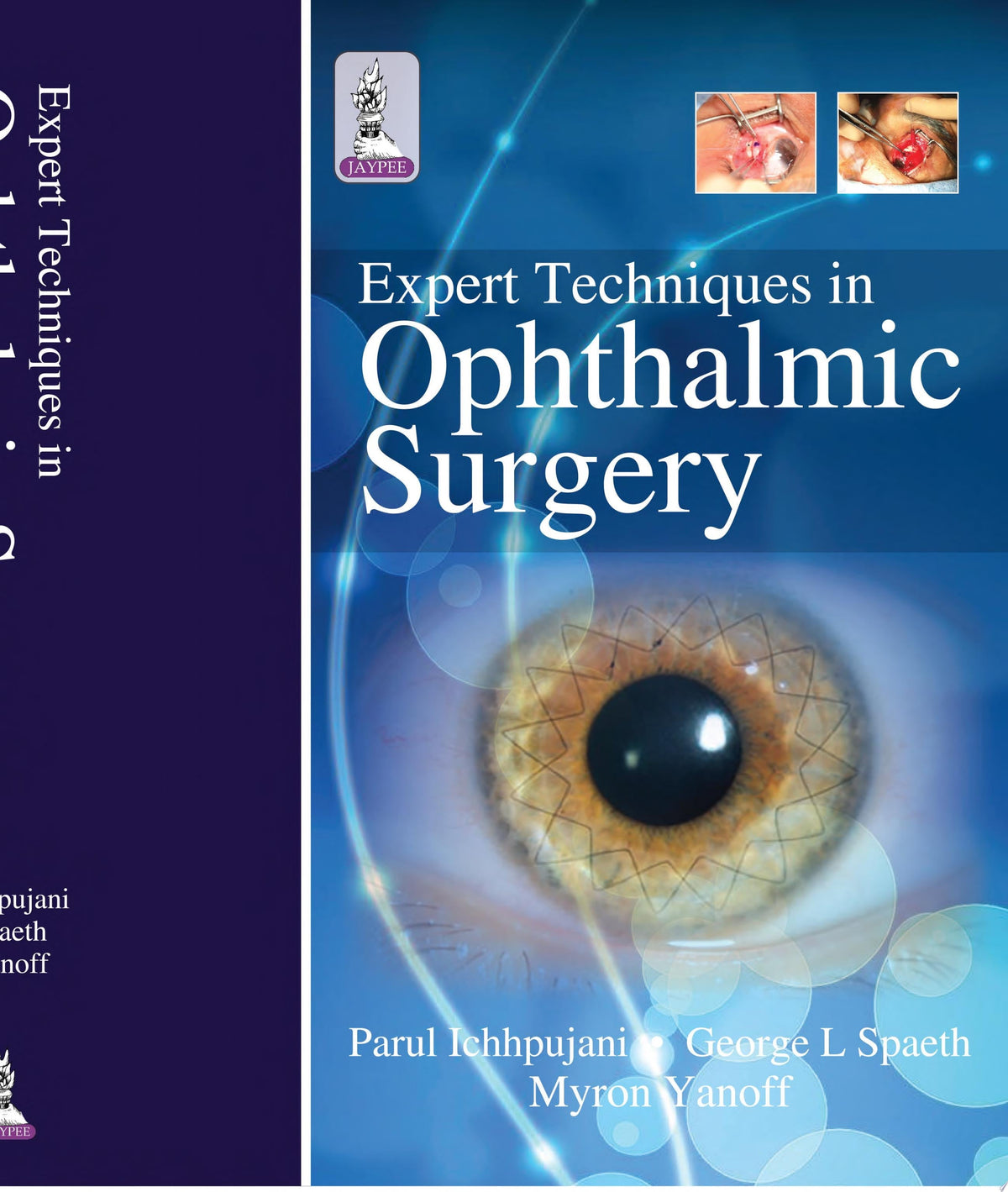 Expert Techniques in Ophthalmic Surgery 2nd Edition by Jaypee PDF