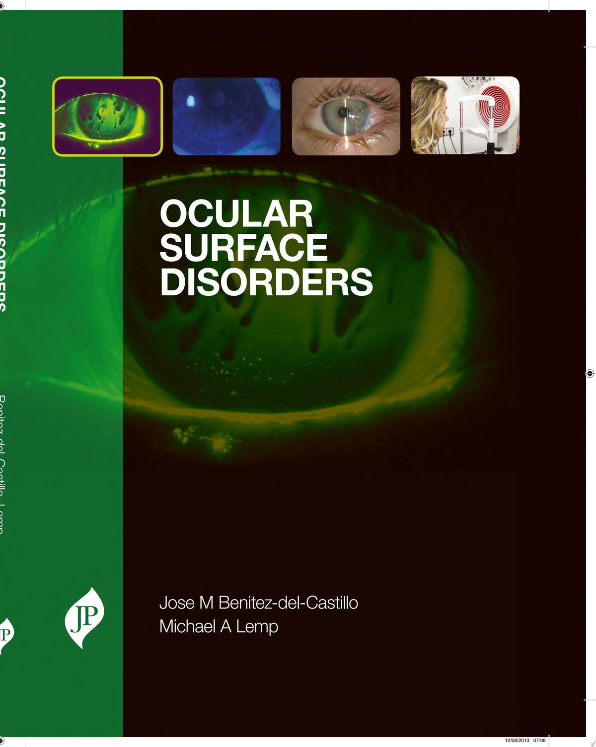 Disorders of Cornea and Ocular Surface 1st Edition by Benitez-del-Castillo PDF