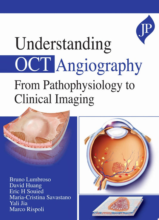 OCT Angiography 1st Edition PDF