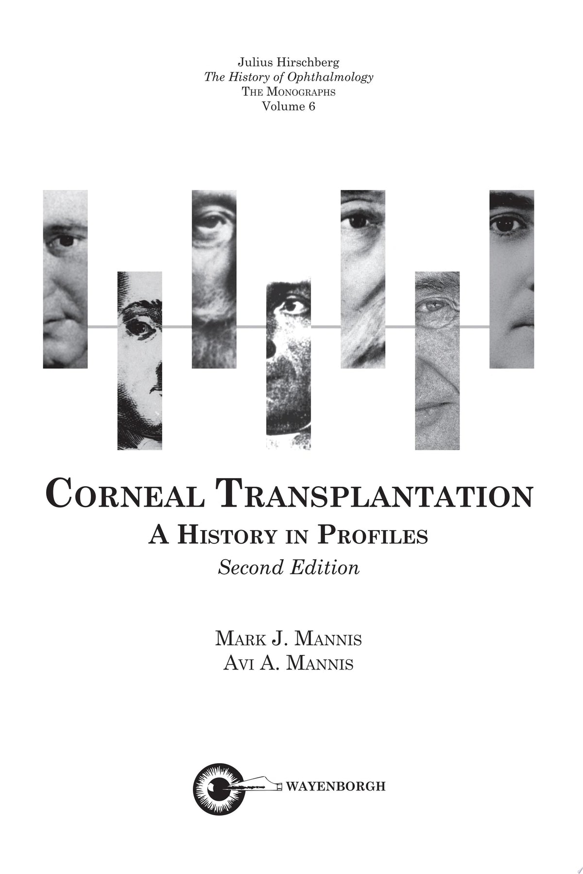 Corneal Transplantation 3rd Edition by Mannis PDF