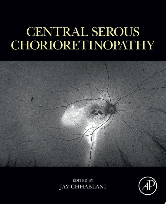 Central Serous Chorioretinopathy 1st Edition PDF