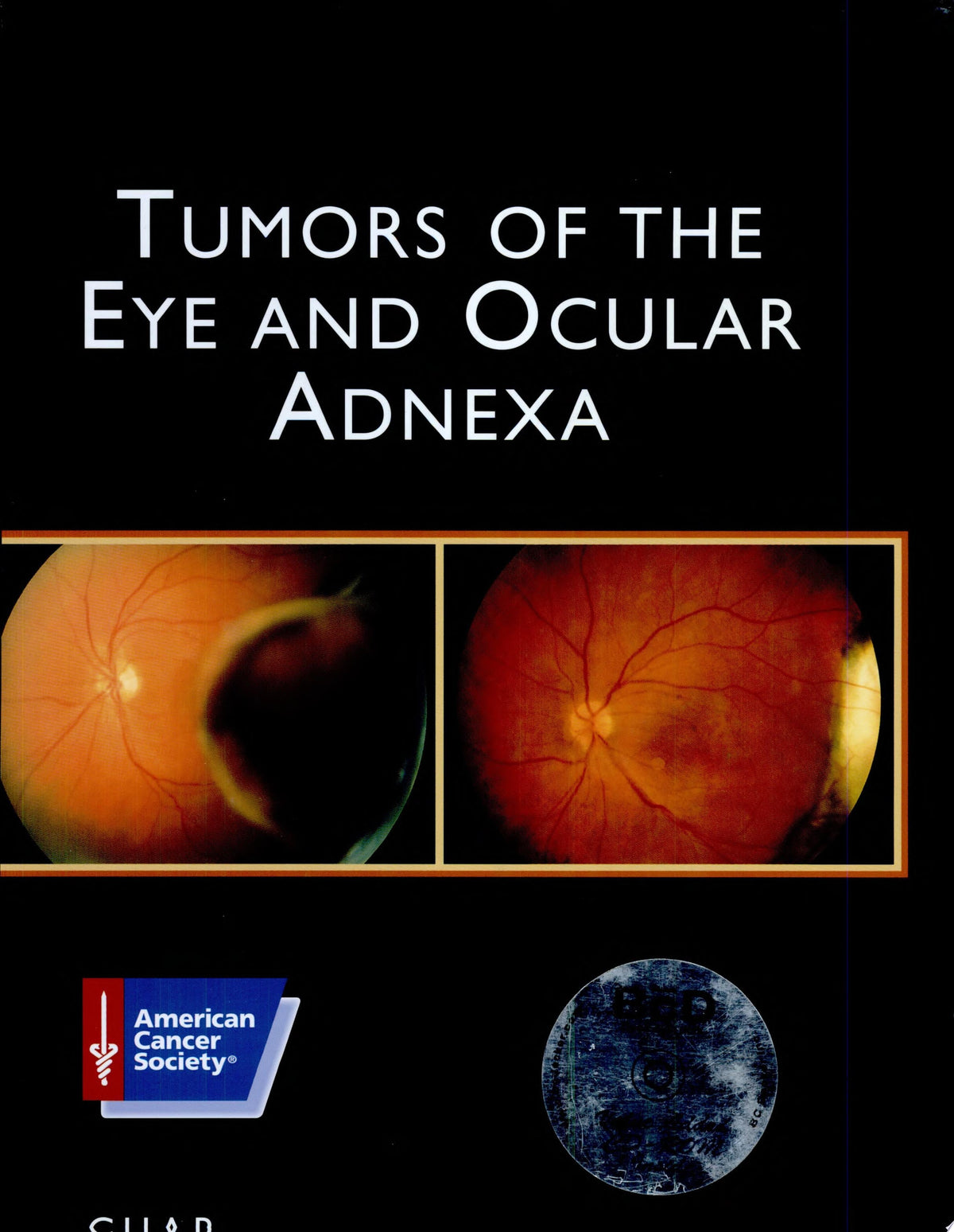 Tumors of the Eye and Ocular Adnexa 1st Edition by American Registry of Pathology PDF