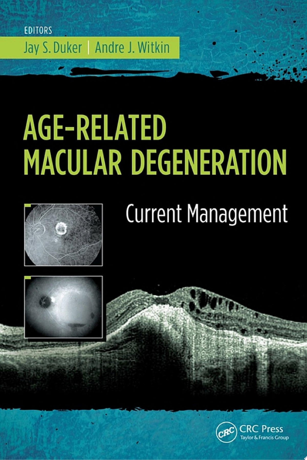 Age-Related Macular Degeneration 1st Edition by Slack Incorporated PDF