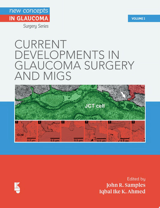 Current Developments in Glaucoma Surgery and MIGS: 3 PDF
