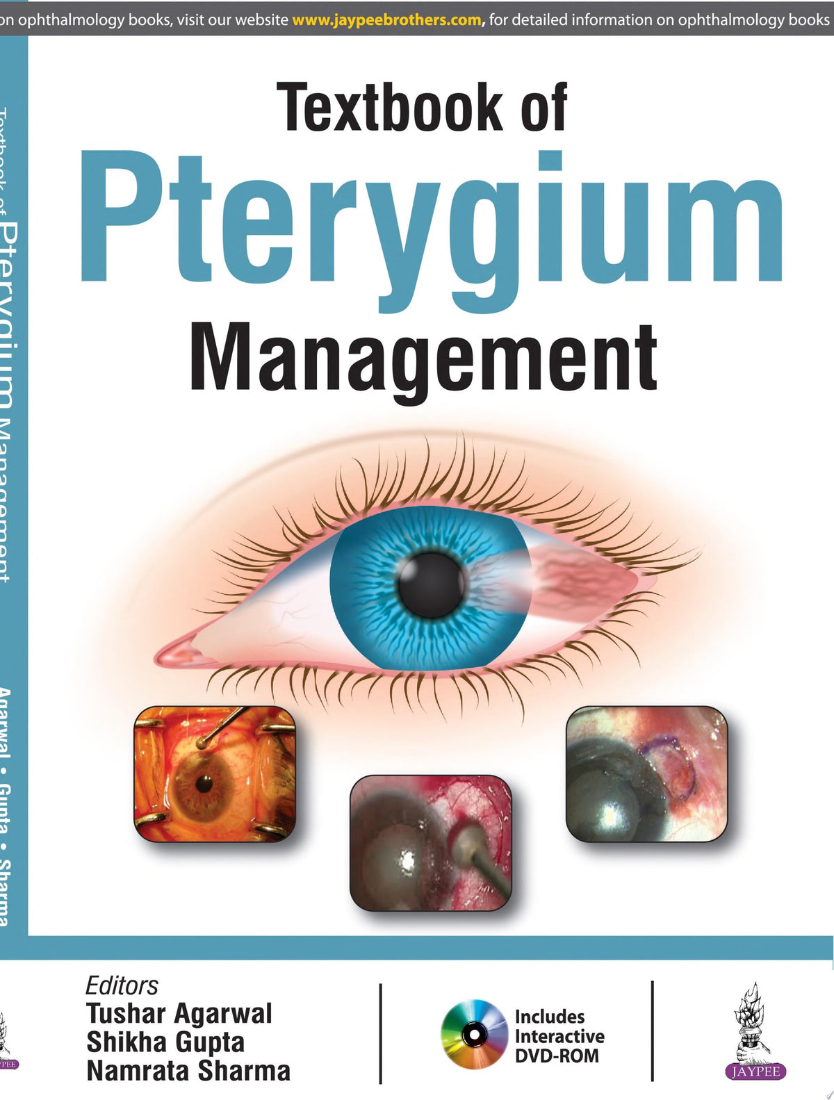Textbook of Pterygium Management 1st Edition PDF