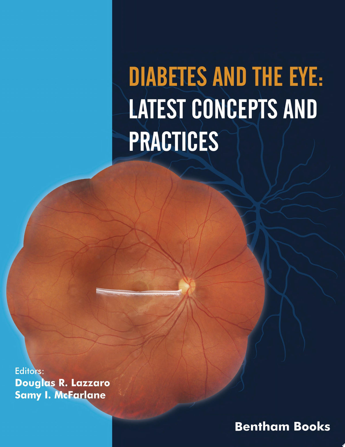 Diabetes and the Eye 1st Edition by Bentham Science PDF