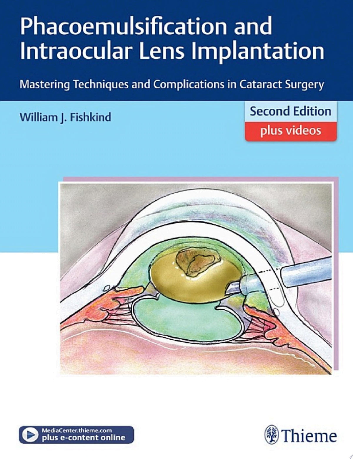Phacoemulsification and Intraocular Lens Implantation 2nd Edition by Fishkind PDF
