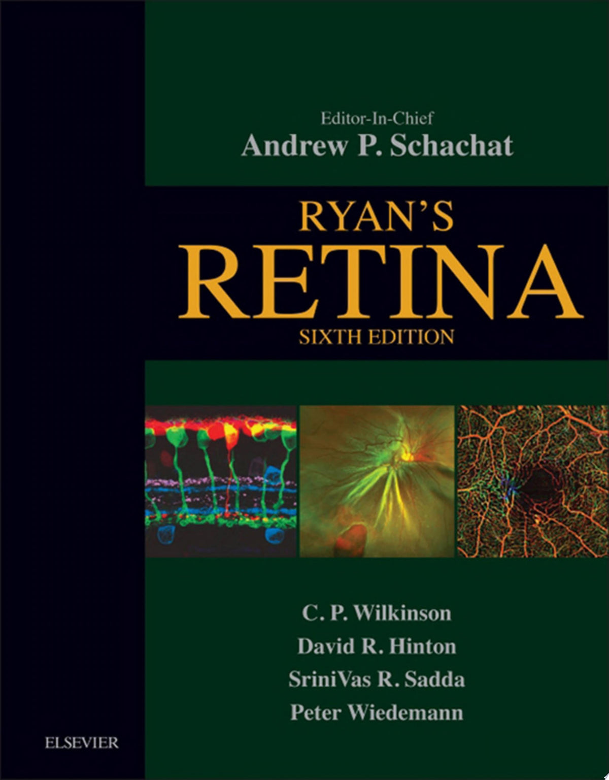 Ryan's Retina 6th Edition by Elsevier PDF