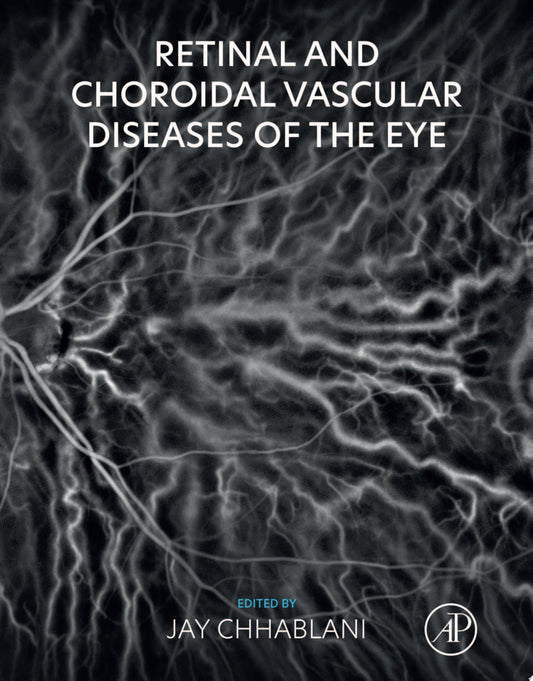 Retinal and Choroidal Vascular Diseases of the Eye 1st Edition PDF