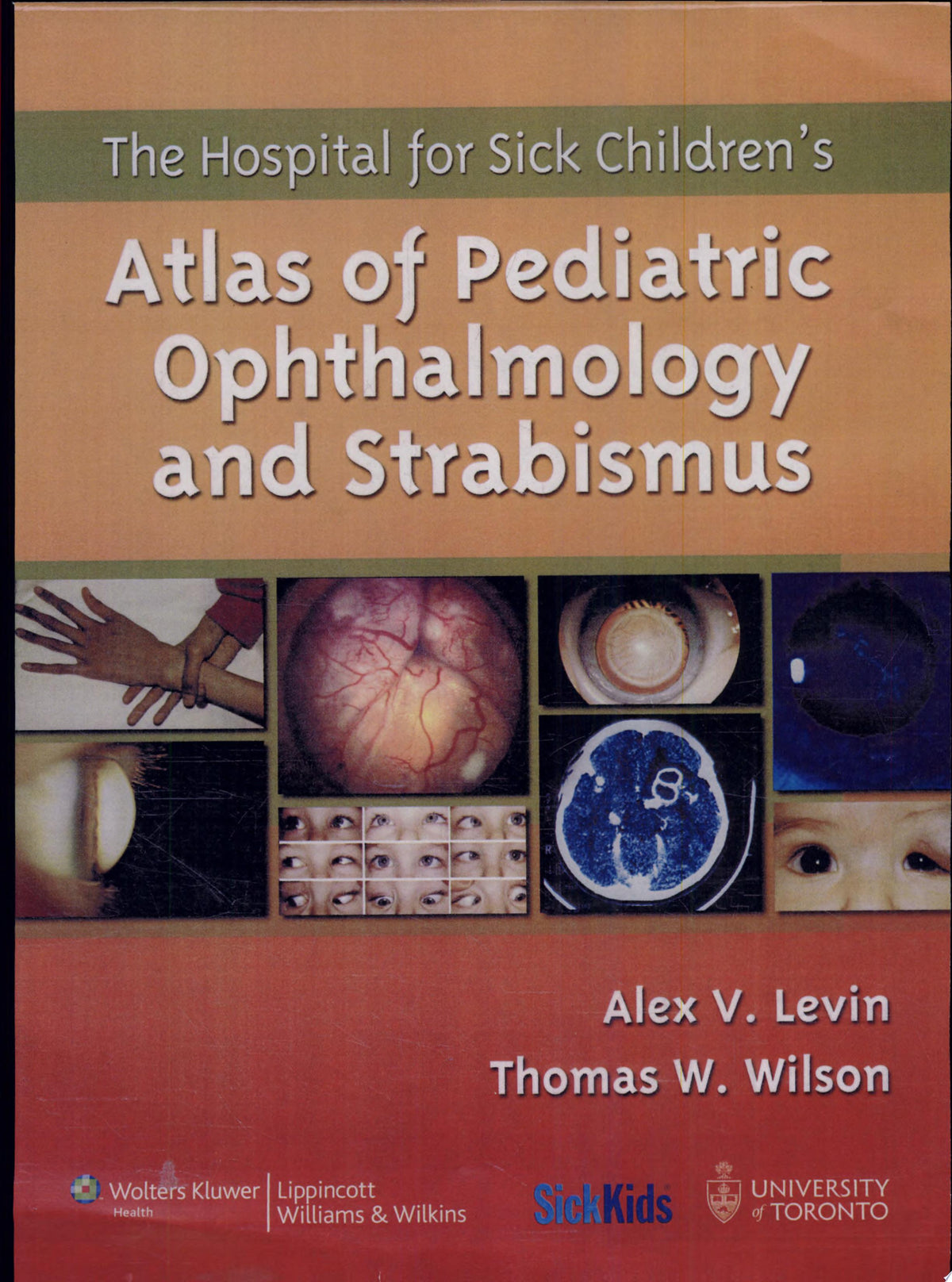Atlas of Pediatric Ophthalmology & Strabismus 1st Edition by LWW PDF