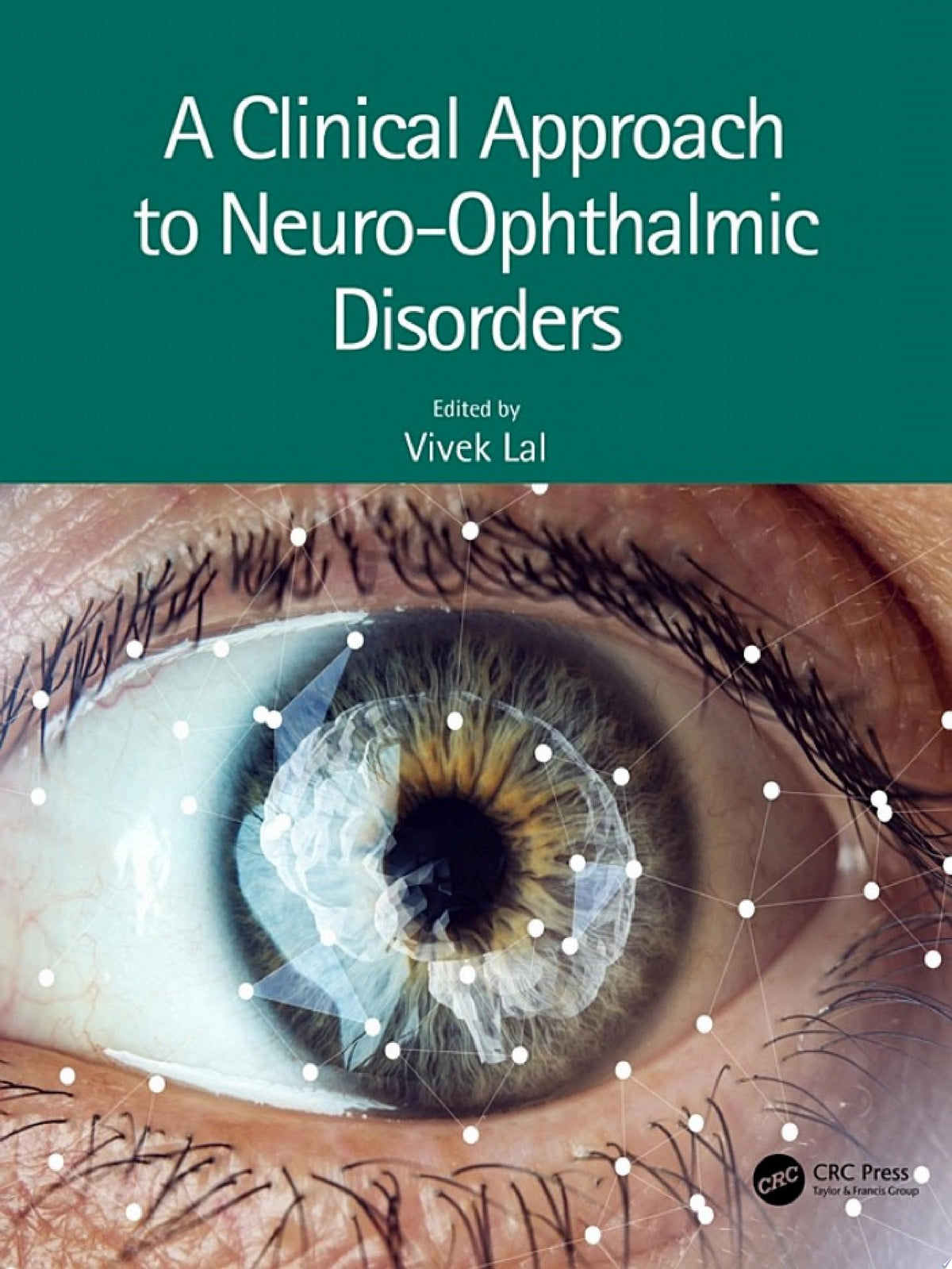 A Clinical Approach to Neuro-Ophthalmic Disorders 1st Edition by CRC Press PDF