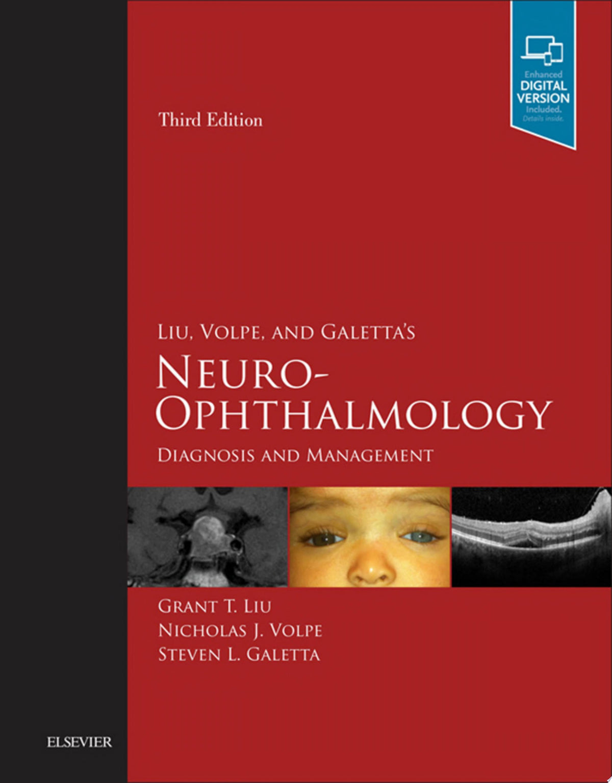 Neuro-Ophthalmology 3rd Edition PDF