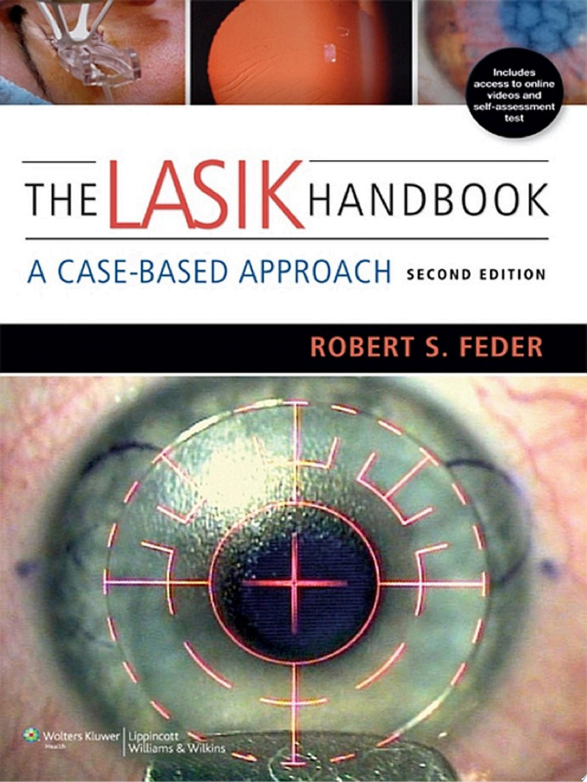 The LASIK Handbook: A Case-Based Approach 2nd Edition by Lippincott Williams & Wilkins PDF