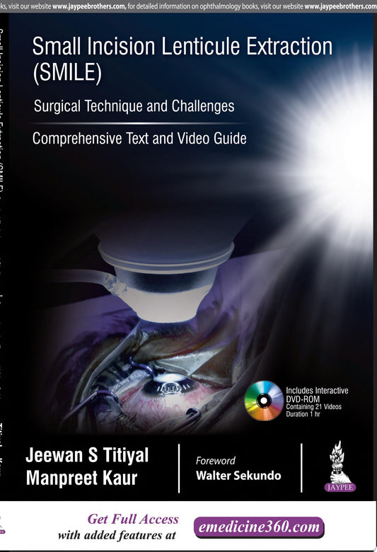 Small Incision Lenticule Extraction 1st Edition by Jaypee PDF