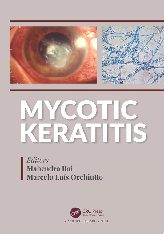 Mycotic Keratitis 1st Edition PDF