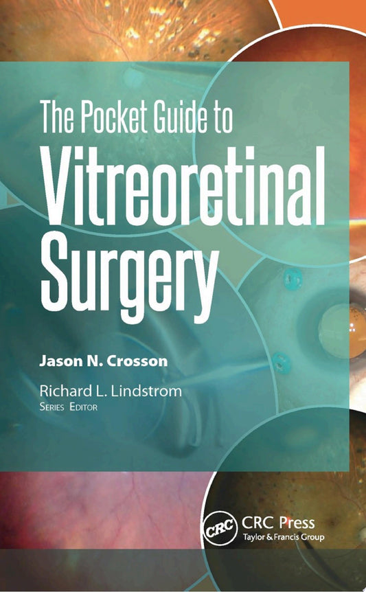 Pocket Guide to Vitreoretinal Surgery 1st Edition by Slack Incorporated PDF