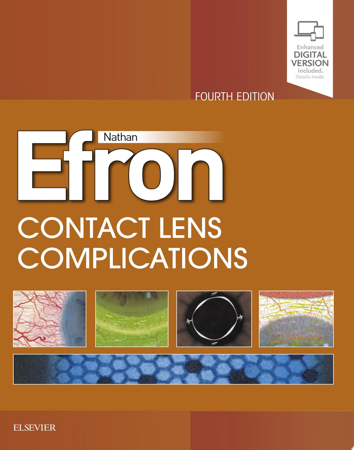 Contact Lens Complications 4th Edition by Efron PDF