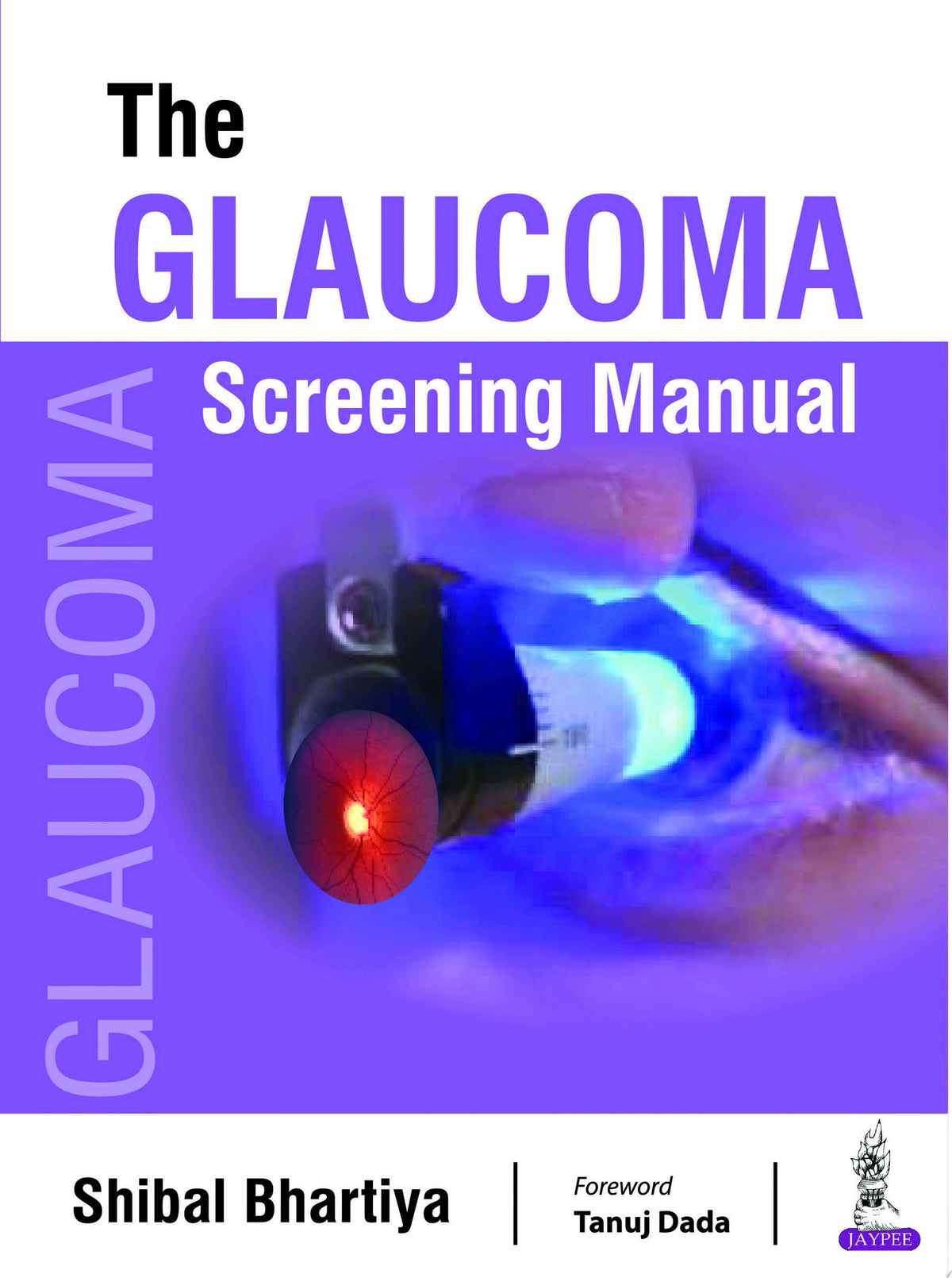 The Glaucoma Screening Manual 1st Edition by Bhartiya PDF