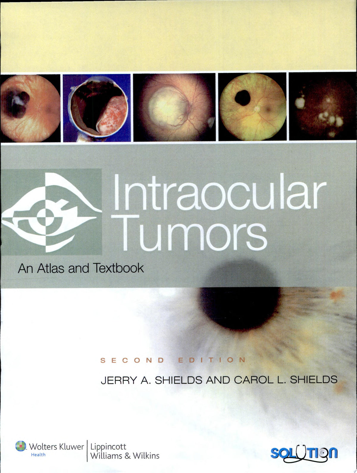 Intraocular Tumors An Atlas and Textbook 1st Edition PDF