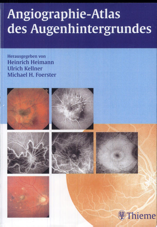 Atlas of Fundus Angiography 1st Edition by Foerster PDF