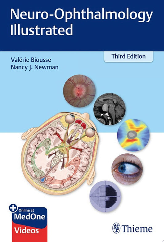 Neuro-Ophthalmology Illustrated 3rd Edition by Thieme PDF
