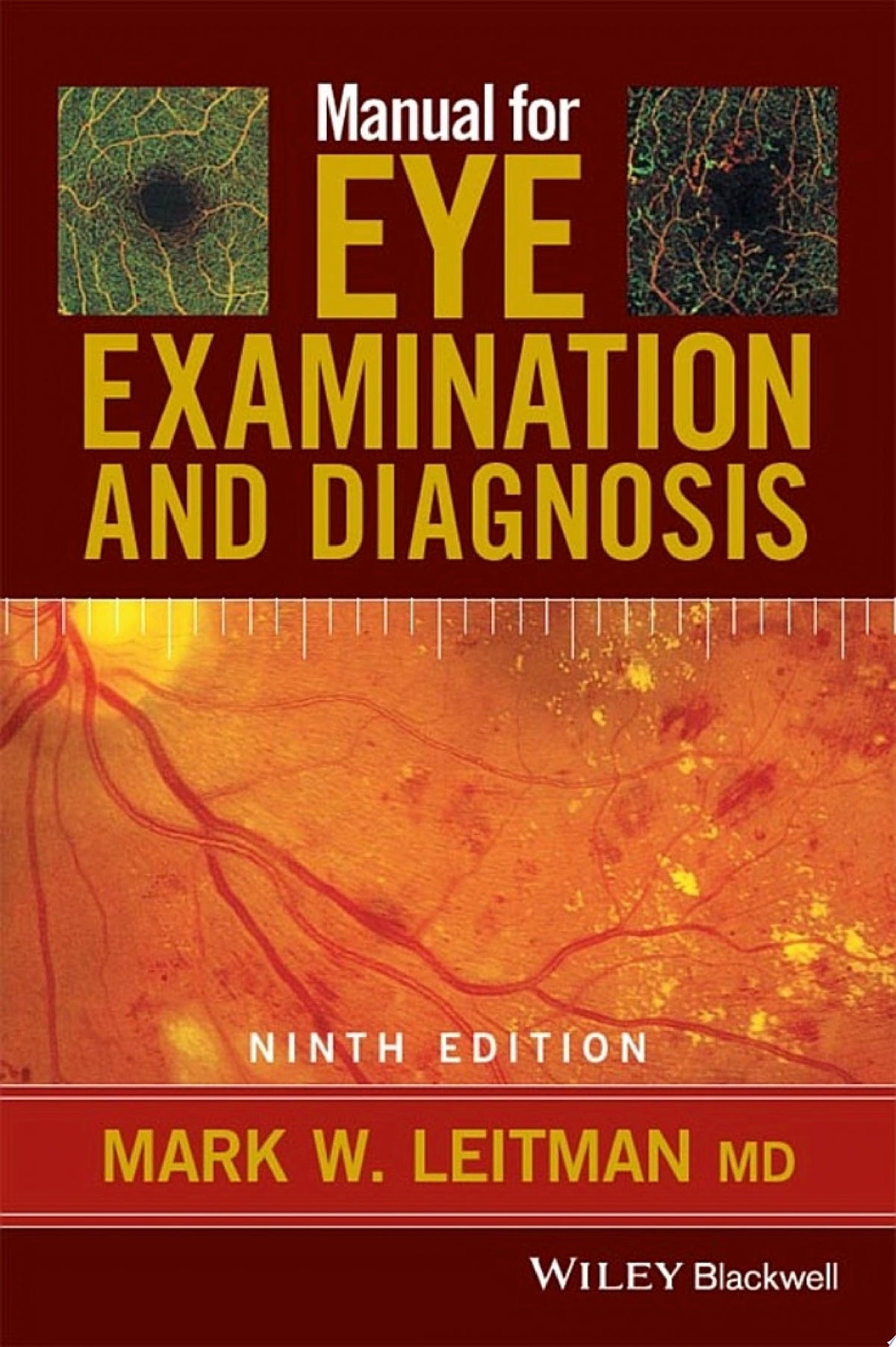 Manual for Eye Examination and Diagnosis PDF