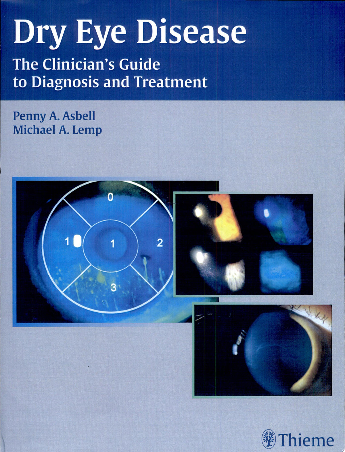 Dry Eye Disease 1st Edition by Elsevier PDF