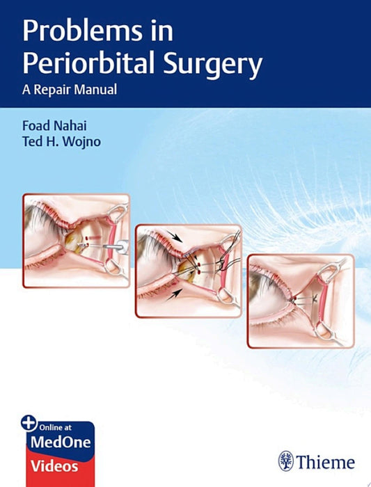 Problems in Periorbital Surgery 1st Edition by Thieme PDF