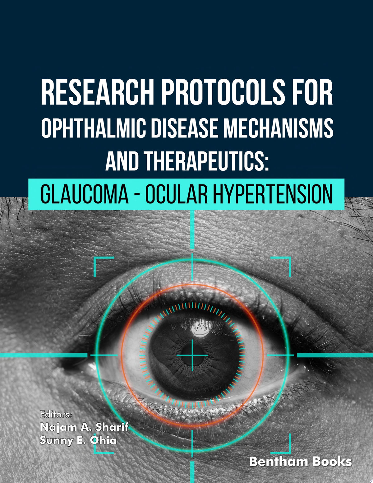 Research Protocols for Ophthalmic Disease: Glaucoma by Sharif PDF