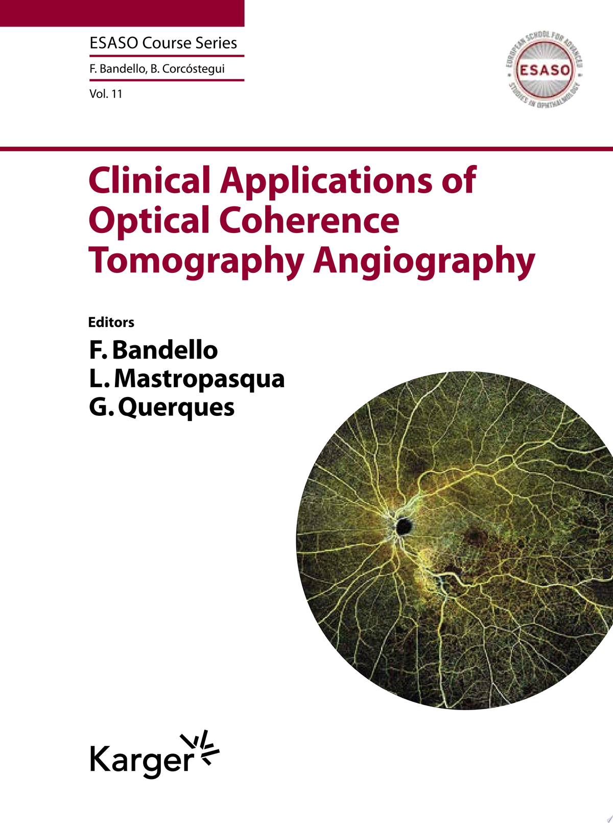 Clinical Applications of Optical Coherence Tomography Angiography 1st Edition by Bandello PDF