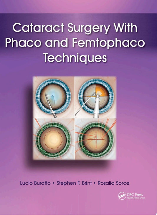 Cataract Surgery with Phaco and Femtophaco 1st Edition by Brint PDF