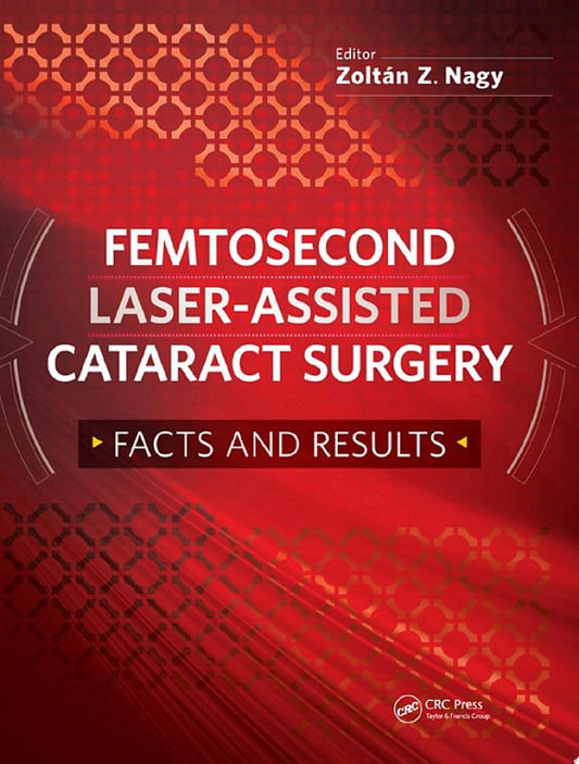 Femtosecond Laser-Assisted Catarac Surgery 1st Edition by Slack Incorporated PDF