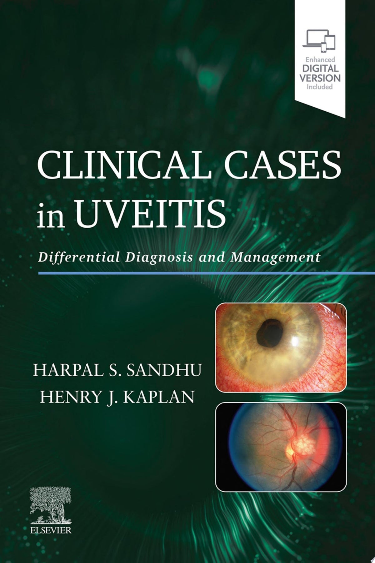 Clinical Cases in Uveitis 1st Edition PDF