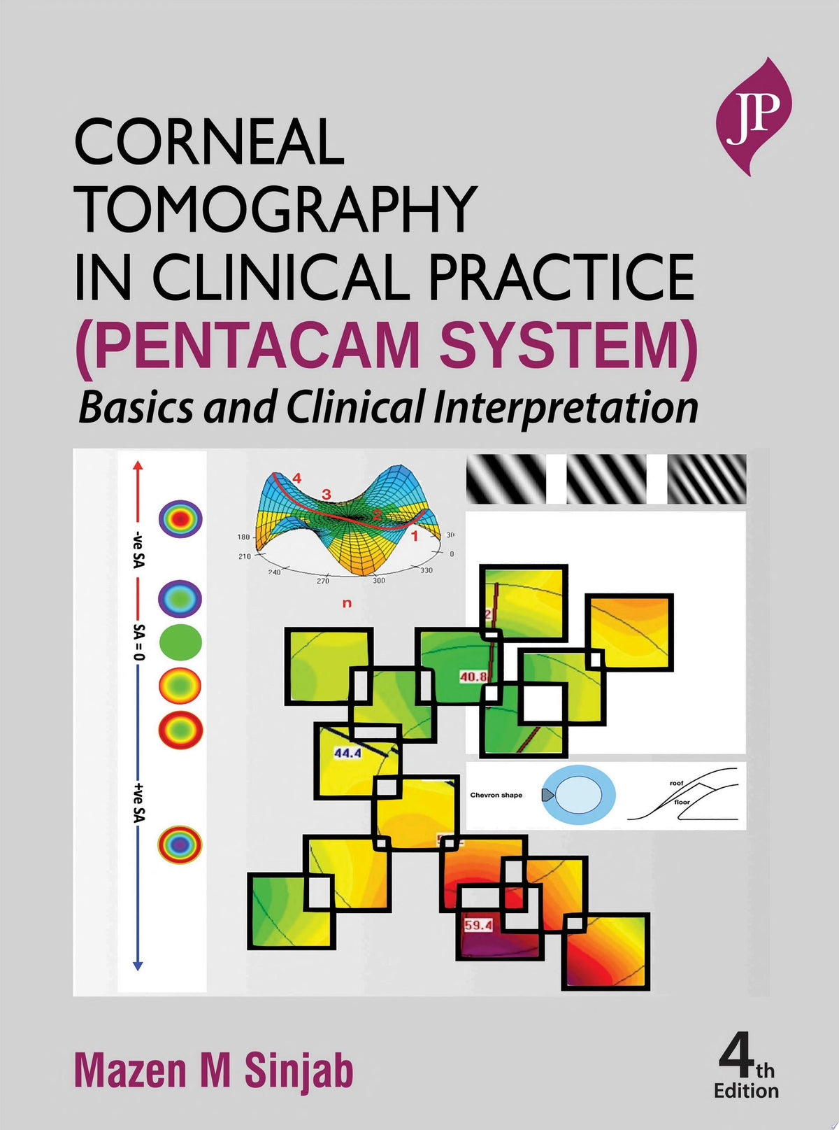 Corneal Tomography in Clinical Practice 4th Edition by Sinjab PDF